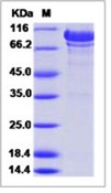 Human N-Cadherin / CD325 / CDH2 Recombinant Protein (ECD, His Tag)(Discontinued)