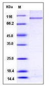 Human PARP-3 / PARP3 Recombinant Protein (His & GST Tag)(Discontinued)