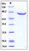 Human DNMT2 / TRDMT1 Recombinant Protein (GST Tag)(Discontinued)