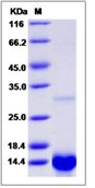 Human TGFA / TGF-alpha Recombinant Protein(Discontinued)