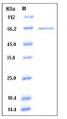 Human HDAC3 / Histone deacetylase 3 Recombinant Protein (His & GST Tag)(Discontinued)