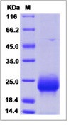 Human FSH Beta / FSHB Recombinant Protein (His Tag)(Discontinued)