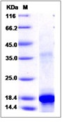 Human KIT / c-KIT / CD117 Recombinant Protein (aa 50-190, His Tag)(Discontinued)