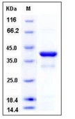 Human IKB alpha / NFKBIA Recombinant Protein (His Tag)(Discontinued)