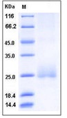 Human CD160 Recombinant Protein (His Tag)(Discontinued)