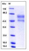 Human NGFR/ P75 Recombinant Protein (His Tag)(Discontinued)