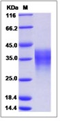 Human LIF Recombinant Protein(Discontinued)