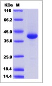 Human LY-6D / LY6D Recombinant Protein (Fc Tag)(Discontinued)