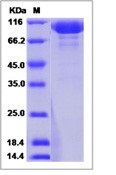 Human Pregnancy Specific GlycoRecombinant Protein 1 Recombinant Protein (Fc Tag)(Discontinued)