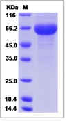 Human Pregnancy Specific GlycoRecombinant Protein 1 Recombinant Protein (His Tag)(Discontinued)