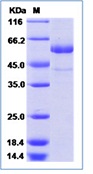 Human TSH Receptor/TSHR (His Tag)(Discontinued)