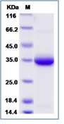 Human IgE-Fc Recombinant Protein (Constant Domain 3&4, His Tag)(Discontinued)