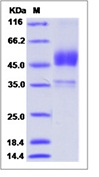 Mouse ALK-6 / BMPR1B Recombinant Protein (Fc Tag)(Discontinued)