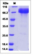 Mouse PD-L1 / B7-H1 / CD274 Recombinant Protein (ECD, Fc Tag)(Discontinued)