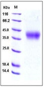 Mouse 4-1BBL / CD137L / TNFSF9 Recombinant Protein (His Tag)(Discontinued)