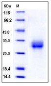 Mouse ALK-3 / BMPR1A Recombinant Protein (His Tag)(Discontinued)