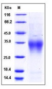 Mouse CD28 Recombinant Protein (His Tag)(Discontinued)