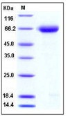 Mouse Nogo Receptor / NOGOR / RTN4R Recombinant Protein (His Tag)(Discontinued)