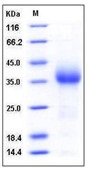 Mouse CD27 / TNFRSF7 Recombinant Protein (His Tag)(Discontinued)