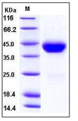 Mouse CD38 Recombinant Protein (His Tag)(Discontinued)