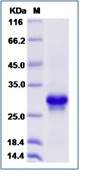 Mouse CD40 / TNFRSF5 Recombinant Protein (His Tag)(Discontinued)