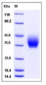 Mouse ICOS / AILIM / CD278 Recombinant Protein (Fc Tag)(Discontinued)