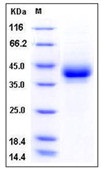 Mouse CD209B / DC-SIGNR1 Recombinant Protein (His Tag)(Discontinued)