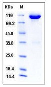 Mouse c-kit / CD117 Recombinant Protein (Fc Tag)(Discontinued)