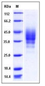 Mouse CD2 / LY37 Recombinant Protein (His Tag)(Discontinued)