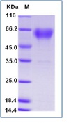 Mouse CD68 Recombinant Protein (His Tag)(Discontinued)