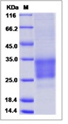 Mouse CD69 / CLEC2C / AIM Recombinant Protein (His Tag, ECD)(Discontinued)