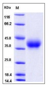 Mouse CD84 Recombinant Protein (His Tag)(Discontinued)