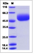 Mouse CD160 Recombinant Protein (Fc Tag)(Discontinued)