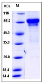 Mouse CD137 / 4-1BB / TNFRSF9 Recombinant Protein (Fc Tag)(Discontinued)