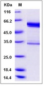 Mouse tPA / PLAT Recombinant Protein (Fc Tag)(Discontinued)