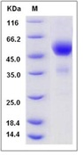 Mouse TIGIT / VSTM3 Recombinant Protein (Fc Tag)(Discontinued)