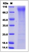 Mouse FLT-3 / CD135 / FLK-2 Recombinant Protein (His Tag)(Discontinued)