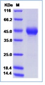 Mouse ALK-4 / ACVR1B Recombinant Protein (Fc Tag)(Discontinued)