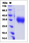 Mouse B7-H5 / GI24 / VISTA Recombinant Protein (ECD, His Tag)(Discontinued)