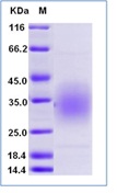 Mouse CD47 Recombinant Protein(Discontinued)