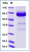 Human CD73 / NT5E Recombinant Protein (His Tag)(Discontinued)