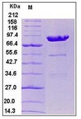 Human Carboxypeptidase E / CPE Recombinant Protein (Fc Tag)(Discontinued)