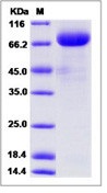 Human VEGFR1 / FLT-1 Recombinant Protein (Fc Tag)(Discontinued)