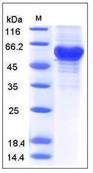 Human Ephrin-A3 / EFNA3 / EFL2 Recombinant Protein (Fc Tag)(Discontinued)