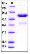 Human FGF9 Recombinant Protein (Fc Tag)(Discontinued)