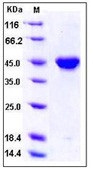 Human PDGF-C Recombinant Protein (Fc Tag)(Discontinued)