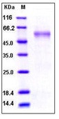 Human MMP7 Recombinant Protein (Fc Tag)(Discontinued)