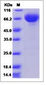 Human B7-DC / PD-L2 / CD273 / PDCD1LG2 Recombinant Protein (Fc Tag)(Discontinued)