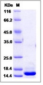 Human HMGB1 / HMG1 Recombinant Protein (His Tag)(Discontinued)