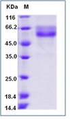 Human HVEM / TNFRSF14 Recombinant Protein (Fc Tag)(Discontinued)